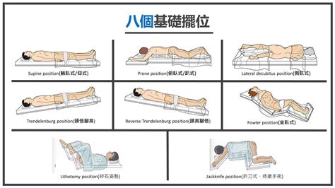 截刀臥位姿勢|患者在手术室中的体位